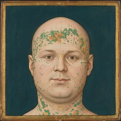 William