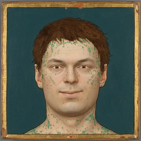 Denis