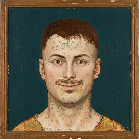 Joerg