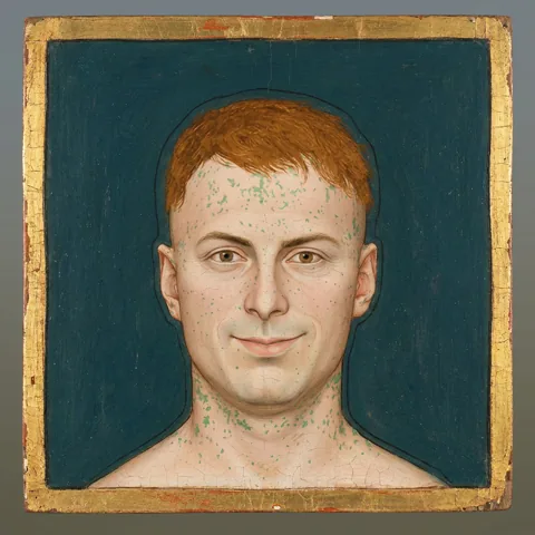 Otto