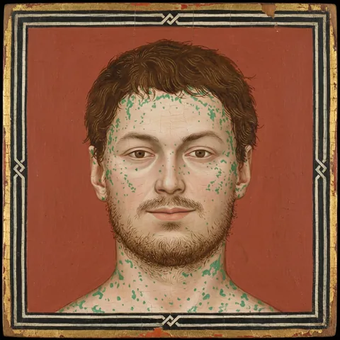 William