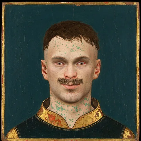László