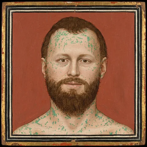 William