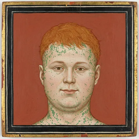 Philip